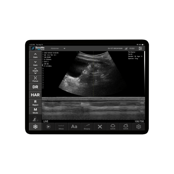 SonoMe H5C Wireless Handheld Ultrasound Scanner - Image 2