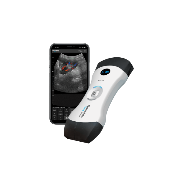 SonoMe H5C10L Wireless Handheld Ultrasound Scanner - Image 3